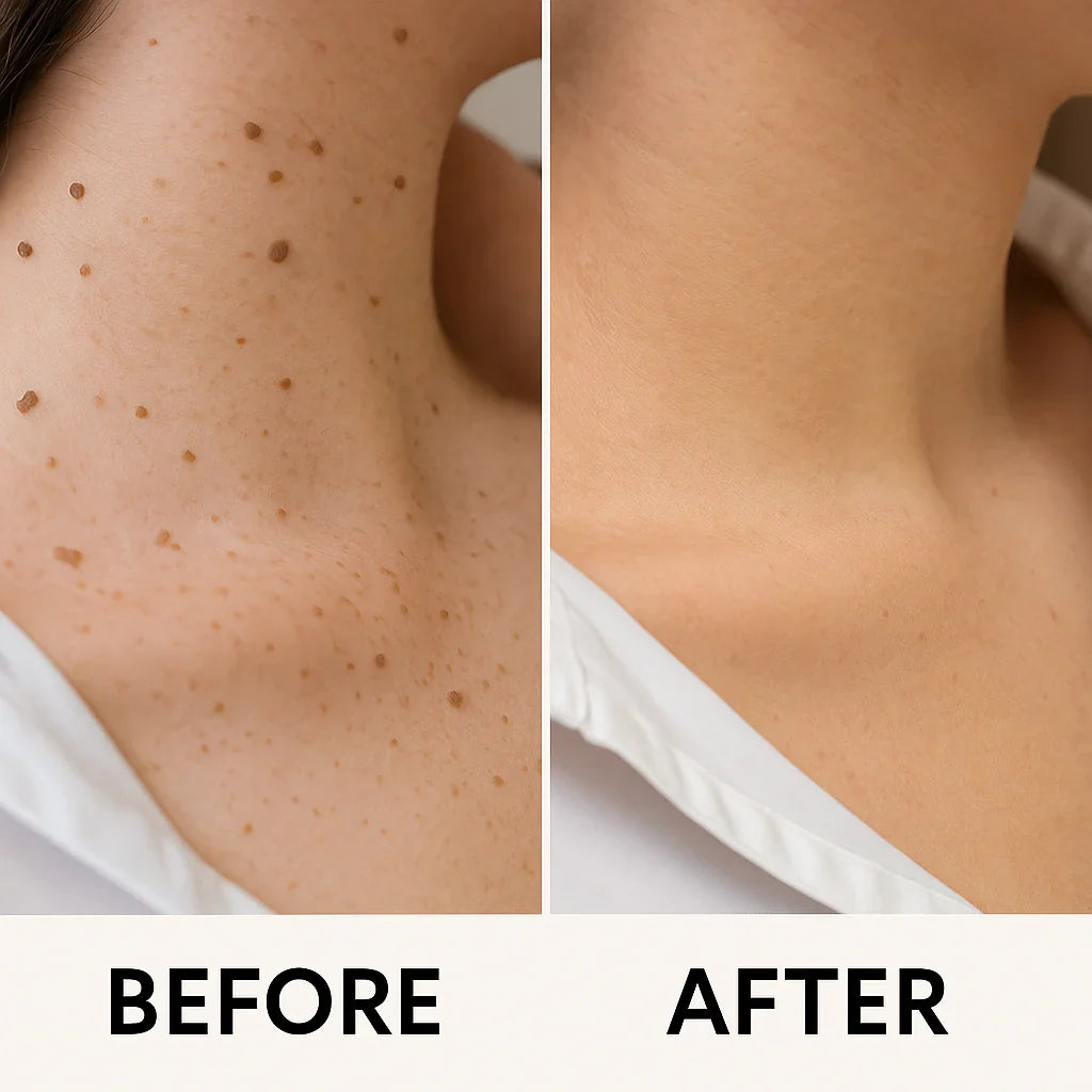 MediSkin Laser